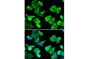 Immunofluorescence analysis of A549 cell using HSPB1 antibody. (HSP27 anticorps  (AA 1-120))