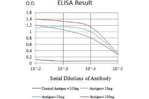 Black line: Control Antigen (100 ng),Purple line: Antigen (10 ng), Blue line: Antigen (50 ng), Red line:Antigen (100 ng)