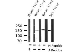 Western blot analysis of Phospho-EGFR (Tyr1172) expression in various lysates (EGFR anticorps  (pTyr1172))