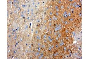 Used in DAB staining on fromalin fixed paraffin-embedded Brain tissue