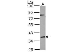 WB Image Sample (30 ug of whole cell lysate) A: NT2D1 10% SDS PAGE antibody diluted at 1:1000 (GPR45 anticorps)