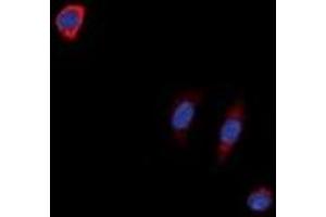Immunofluorescent analysis of NTR1 staining in SKNSH cells. (NTSR1 anticorps)