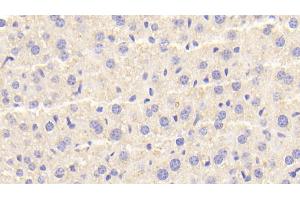 Detection of CTSD in Mouse Liver Tissue using Polyclonal Antibody to Cathepsin D (CTSD) (Cathepsin D anticorps  (AA 66-410))