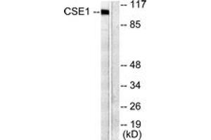 Western blot analysis of extracts from 293 cells, using CSE1L Antibody. (Exportin 2 anticorps  (AA 1-50))