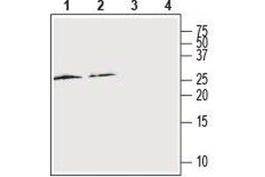 anti-Receptor (G Protein-Coupled) Activity Modifying Protein 2 (RAMP2) (AA 54-68), (Extracellular) antibody