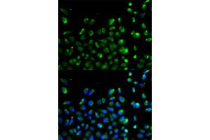 Immunofluorescence analysis of A549 cell using ATG13 antibody. (ATG13 anticorps)