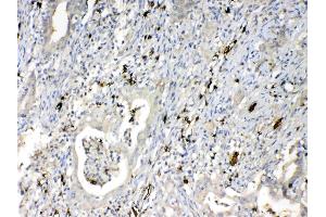 IHC analysis of HBD using anti-HBD antibody .