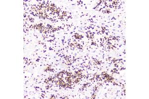 IHC analysis of TNFRSF11B using anti-TNFRSF11B antibody (ABIN7600875).