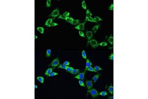 Immunofluorescence analysis of NIH/3T3 cells using VEGFA Rabbit pAb (ABIN6128907, ABIN6150083, ABIN6150084 and ABIN6215912) at dilution of 100 (40x lens). (VEGFA anticorps  (AA 27-126))