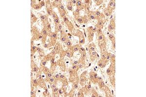 Immunohistochemical analysis of paraffin-embedded H. (FOLH1B anticorps  (AA 155-183))