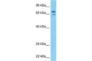 Host:  Rabbit  Target Name:  KCND3  Sample Type:  Stomach Tumor lysates  Antibody Dilution:  1.