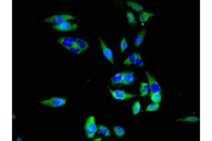 Immunofluorescent analysis of Hela cells using ABIN7170002 at dilution of 1:100 and Alexa Fluor 488-congugated AffiniPure Goat Anti-Rabbit IgG(H+L)
