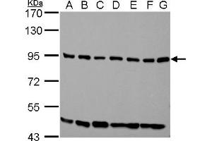 WB Image ELMO1 antibody [C3], C-term detects ELMO1 protein by western blot analysis. (ELMO1 anticorps  (C-Term))