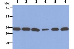 The Cell lysates (40ug) were resolved by SDS-PAGE, transferred to PVDF membrane and probed with anti-human PSMD10 antibody (1:1000).