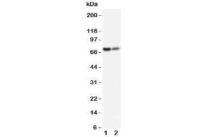 Western blot testing of PMP70 antibody and Lane 1:  rat lung;  2: rat ovary tissue lysate.