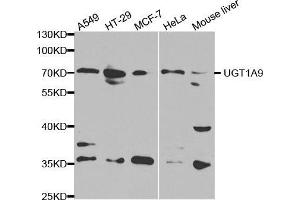 Western blot analysis of extracts of various cell lines, using UGT1A9 antibody. (UGT1A9 anticorps  (AA 26-250))