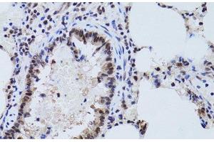 Immunohistochemistry of paraffin-embedded Rat lung using SIRT7 Polyclonal Antibody at dilution of 1:100 (40x lens). (SIRT7 anticorps)