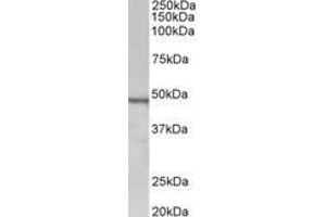 Image no. 1 for anti-Chitotriosidase (CHIT1) (AA 409-423) antibody (ABIN1100790) (Chitotriosidase 1 anticorps  (AA 409-423))