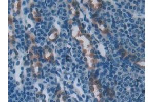 anti-Plastin 3 (PLS3) (AA 5-251) antibody