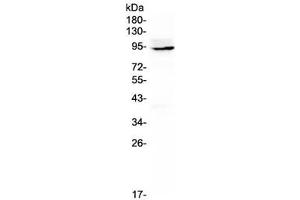Western blot testing of rat thymus lysate with Ptpn22 antibody at 0. (PTPN22 anticorps)