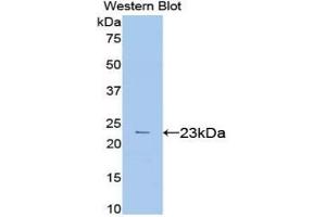 Western blot analysis of the recombinant protein. (VEGFA anticorps  (AA 27-190))