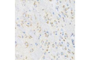 Immunohistochemistry of paraffin-embedded mouse brain using CHIC2 antibody (ABIN6130103, ABIN6138533, ABIN6138534 and ABIN6223980) at dilution of 1:100 (40x lens). (CHIC2 anticorps  (AA 1-165))