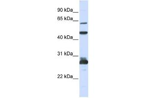 PES1 antibody used at 1 ug/ml to detect target protein. (PES1 anticorps)