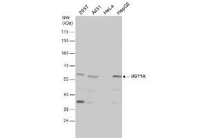 WB Image UGT1A antibody detects UGT1A protein by western blot analysis. (Ugt1 anticorps)