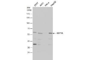 WB Image UGT1A antibody detects UGT1A protein by western blot analysis. (Ugt1 anticorps)