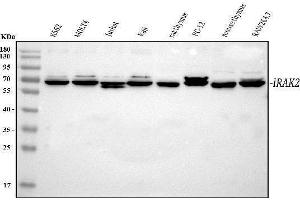 Western blot analysis of IRAK2 using anti-IRAK2 antibody (ABIN7602761).