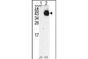 Western blot analysis of PDX1 (arrow) using rabbit polyclonal PDX1 Antibody (N-term) (R). (PDX1 anticorps  (N-Term))