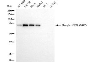 Western blotting analysis using phospho-KIF22 (S427) antibody (ABIN7799202).