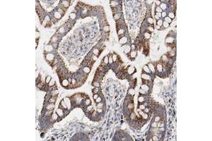 Immunohistochemical staining of human small intestine with SETD3 polyclonal antibody  shows strong cytoplasmic positivity with a granular pattern in glandular cells at 1:50-1:200 dilution. (SETD3 anticorps)