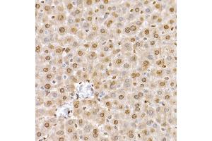 Immunohistochemistry of paraffin-embedded rat heart using SLC14 Rabbit pAb (5991) at dilution of 1:200 (40x lens).