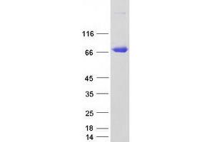 Validation with Western Blot