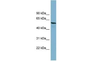 WB Suggested Anti-PGM3  Antibody Titration: 0. (Phosphoglucomutase 3 anticorps  (Middle Region))