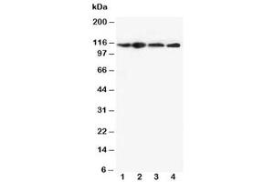 Western blot testing of NLRP3 antibody and Lane 1:  HEP-2