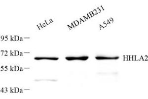 Western blot analysis of HHLA2 (ABIN7074199) at dilution of 1: 300 (HHLA2 anticorps)