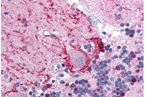 Human Brain, Cerebellum (formalin-fixed, paraffin-embedded) stained with TRIM31 antibody ABIN213720 at 2.