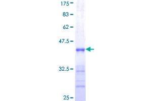 Image no. 1 for Short Stature Homeobox 2 (SHOX2) (AA 117-204) protein (GST tag) (ABIN1319961)