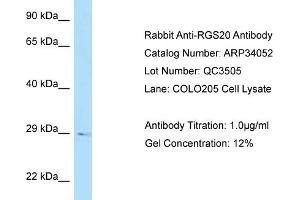 WB Suggested Anti-RGS20 Antibody   Titration: 1.