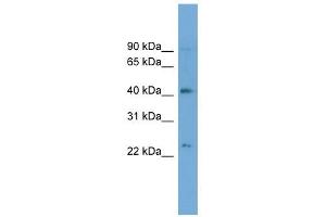 ATP8B2 antibody used at 1 ug/ml to detect target protein. (ATP8B2 anticorps  (N-Term))