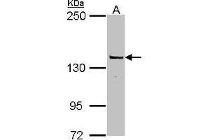 WB Image Sample (30 ug of whole cell lysate) A: MCF-7 5% SDS PAGE antibody diluted at 1:1000