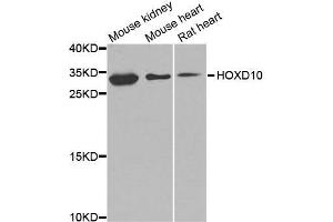 Western blot analysis of extracts of various cell lines, using HOXD10 antibody (ABIN5974761) at 1/1000 dilution. (HOXD10 anticorps)