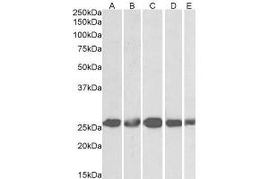 ABIN5539633 (1µg/ml) staining of NIH3T3 (A), HeLa (B), K562 (C), MCF7 (D) and HepG2 (E) lysates (35µg protein in RIPA buffer).