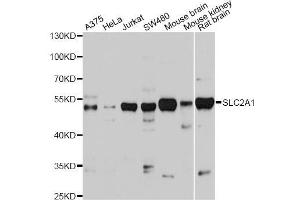 Western blot analysis of extracts of various cell lines, using SLC2A1 antibody (ABIN5975456) at 1/1000 dilution. (GLUT1 anticorps)