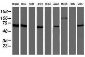 Image no. 3 for anti-Negative Regulator of Ubiquitin-Like Proteins 1 (NUB1) (AA 1-326) antibody (ABIN1490744)