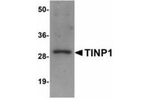 Image no. 1 for anti-NSA2 Ribosome Biogenesis Homolog (NSA2) (C-Term) antibody (ABIN478277) (NSA2 anticorps  (C-Term))