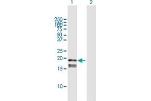 Western Blot analysis of GP9 expression in transfected 293T cell line by GP9 MaxPab polyclonal antibody. (CD42a anticorps  (AA 1-177))