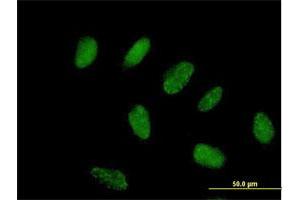 Immunofluorescence of purified MaxPab antibody to FLJ38288 on HeLa cell. (ZNF776 anticorps  (AA 1-476))